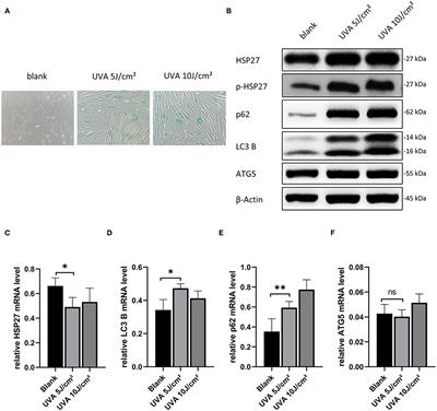 Rapamycin Protects Skin Fibroblasts From UVA-Induced <mark class="highlighted">Photoaging</mark> by Inhibition of p53 and Phosphorylated HSP27
